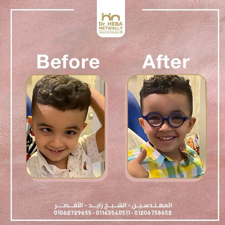 افضل دكتور عيون في المهندسين